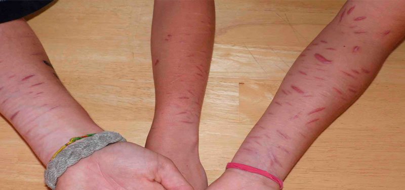 Los peligros del Cutting