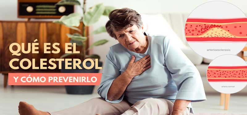 El colesterol como nos afecta y como prevenirlo naturalmente