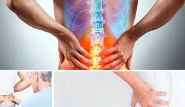 La ciatica sintomas causas y como prevenirlo
